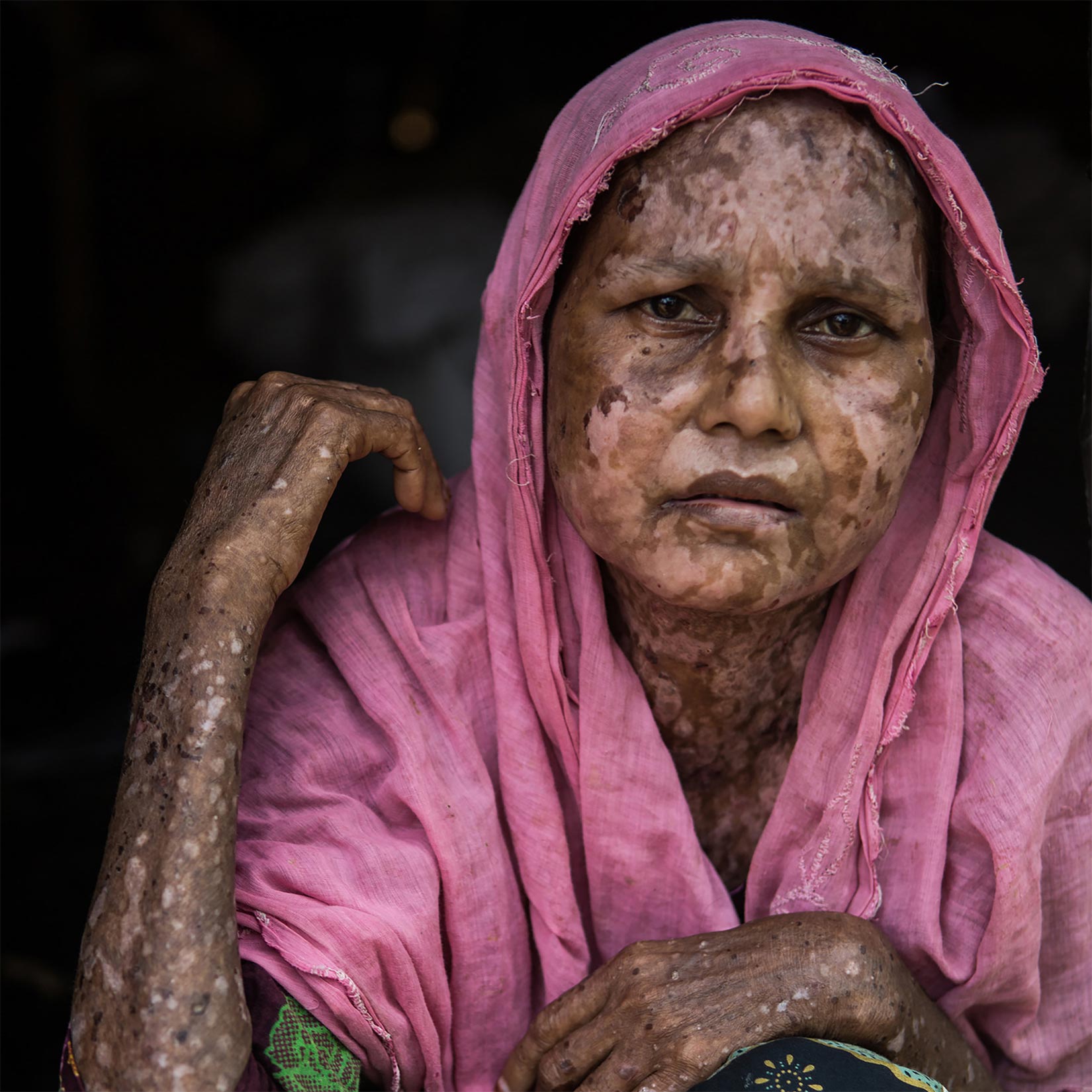 Rohingyaer på flugt fortæller
